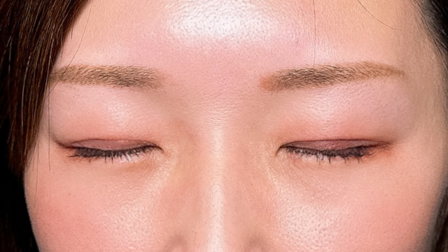 Postoperative Condition Part 1