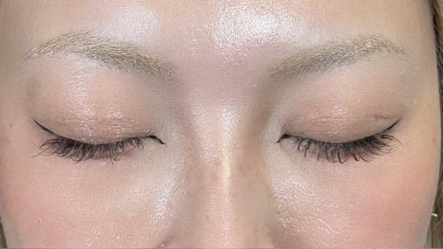 Postoperative Condition Part 1