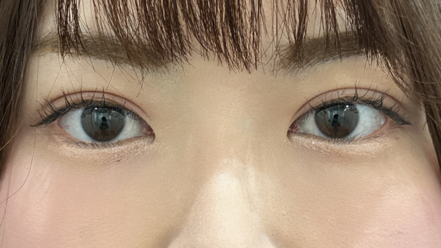 Postoperative Condition Part 1