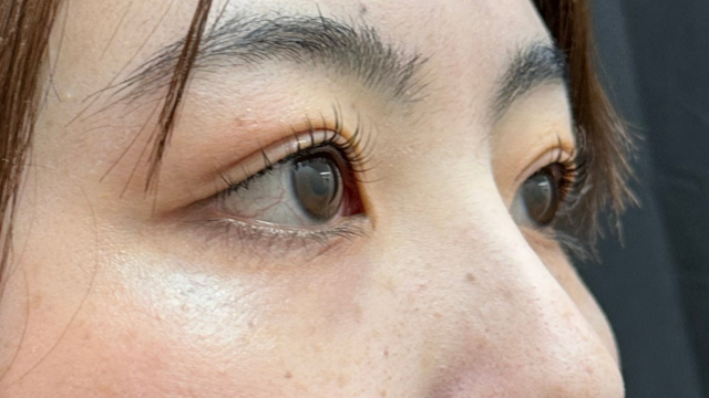 Postoperative Condition Part 1