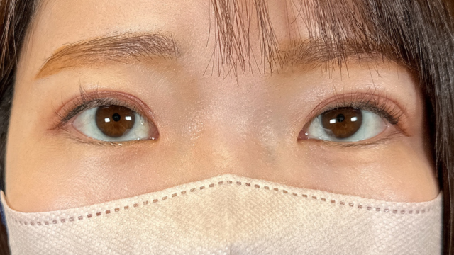 Postoperative Condition Part 1