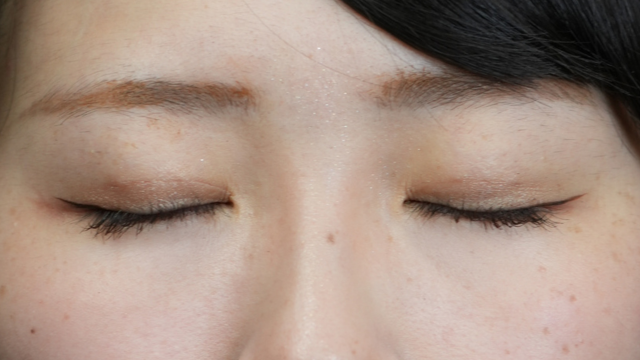 Postoperative Condition Part 1