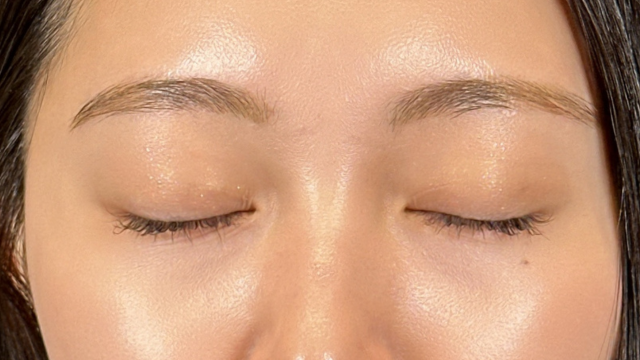 Postoperative Condition Part 1