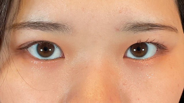 Postoperative Condition Part 1