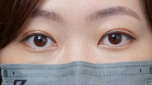 Postoperative Condition Part 1