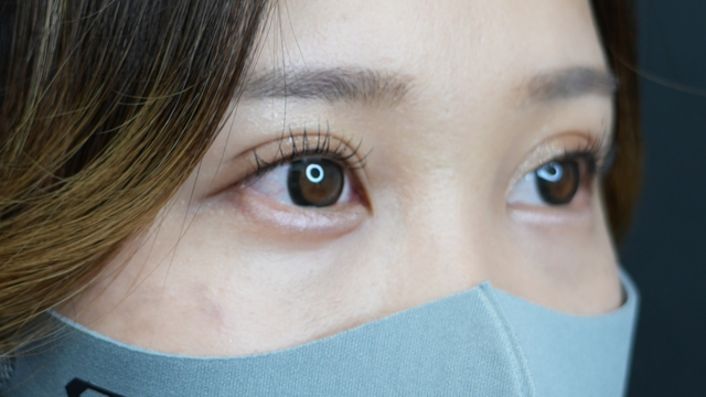 Postoperative Condition Part 1