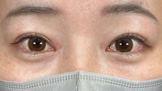 Postoperative Condition Part 1