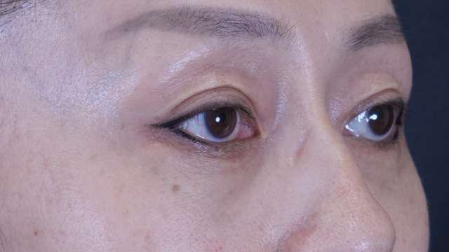 Postoperative Condition Part 1