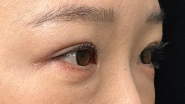 Postoperative Condition Part 1