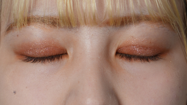 Postoperative Condition Part 1