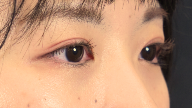 Postoperative Condition Part 1