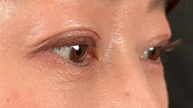 Postoperative Condition Part 1