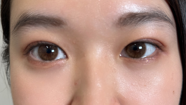 Postoperative Condition Part 1