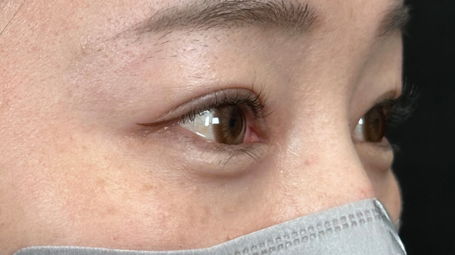 Postoperative Condition Part 1