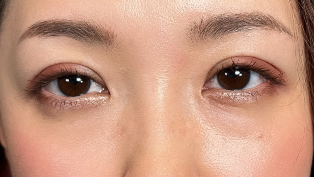 Postoperative Condition Part 1