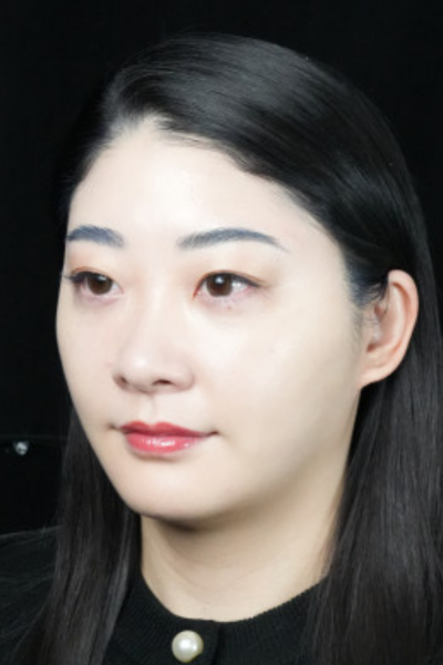 手術前の状態 その1