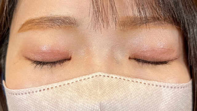 Postoperative Condition Part 1