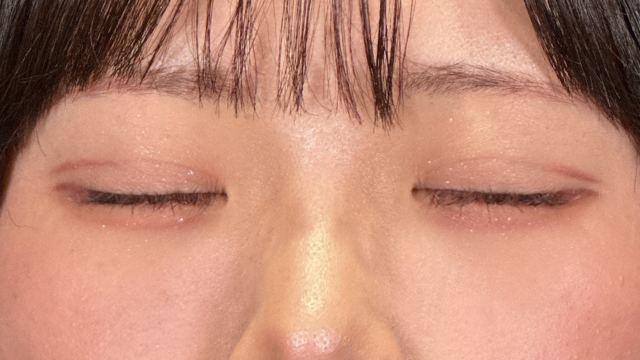 Postoperative Condition Part 1