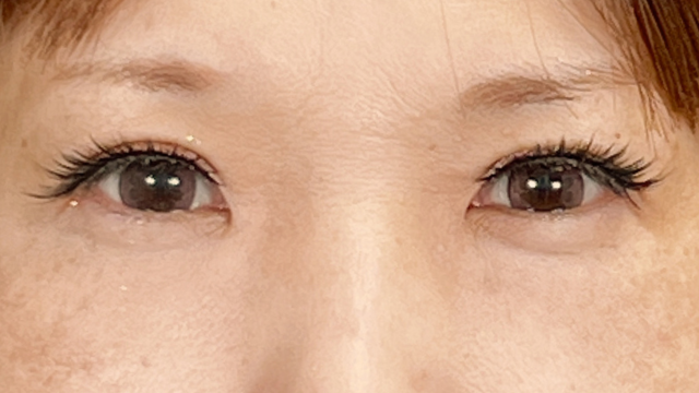 Postoperative Condition Part 1