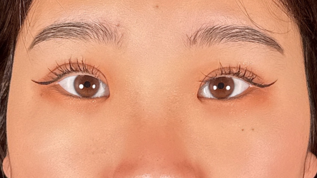 Postoperative Condition Part 1