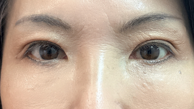 Postoperative Condition Part 1