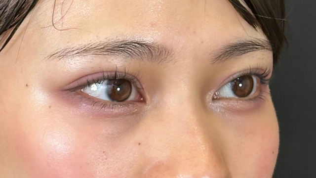 Postoperative Condition Part 1