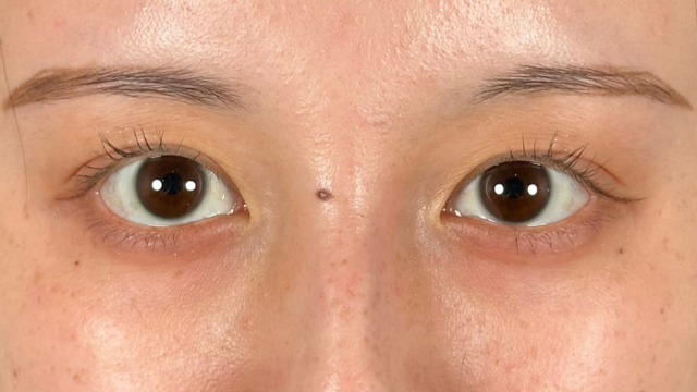 Postoperative Condition Part 1