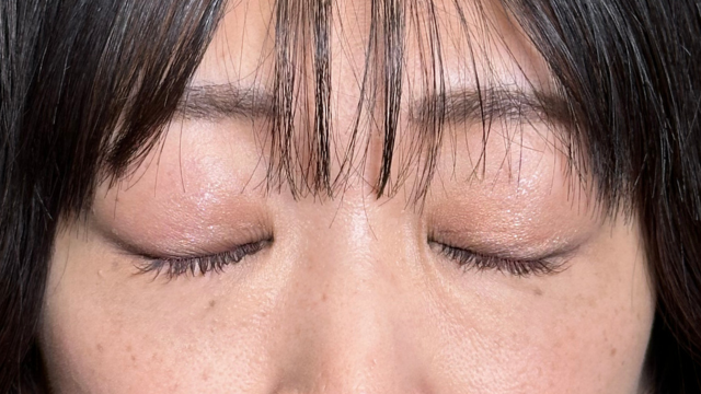 Postoperative Condition Part 1