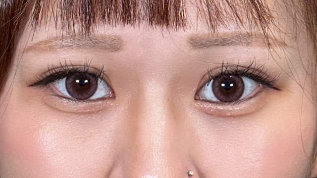 Postoperative Condition Part 1