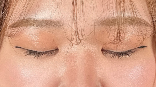 Postoperative Condition Part 1