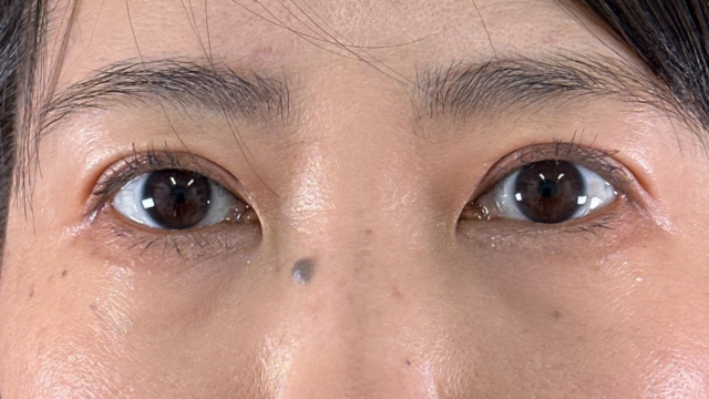 Postoperative Condition Part 1