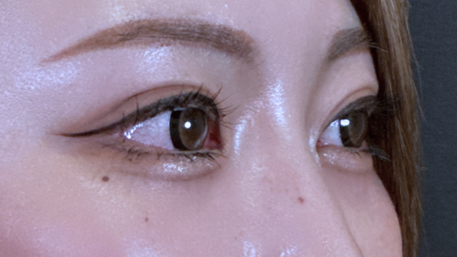 Postoperative Condition Part 1