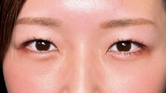 Postoperative Condition Part 1