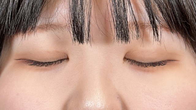 Postoperative Condition Part 1