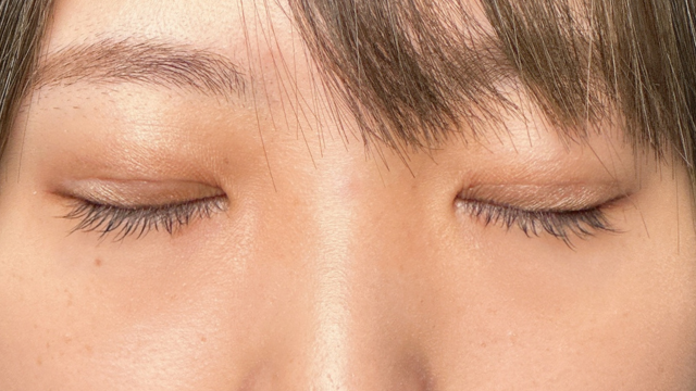 Postoperative Condition Part 1