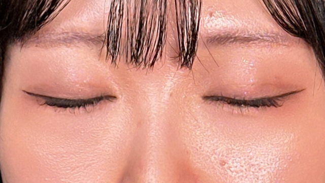 Postoperative Condition Part 1