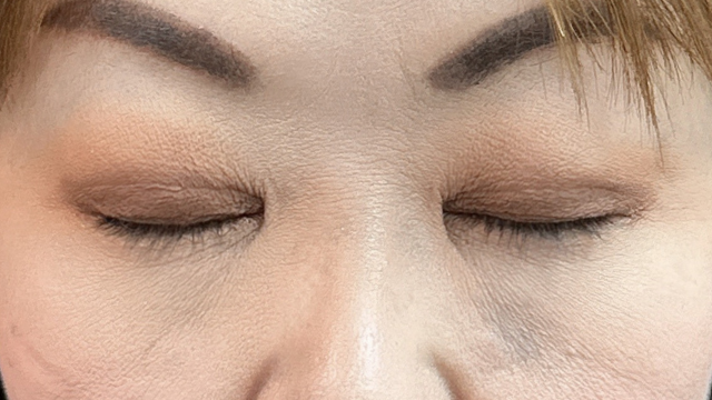 Postoperative Condition Part 1