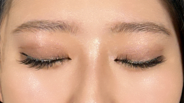 Postoperative Condition Part 1