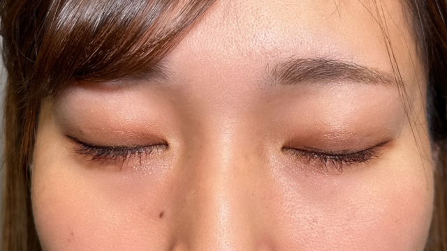 Postoperative Condition Part 1