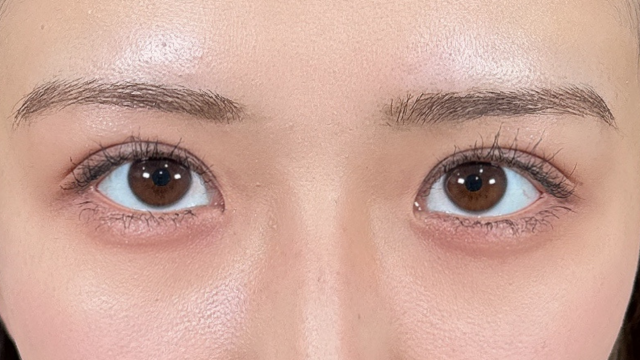 Postoperative Condition Part 1