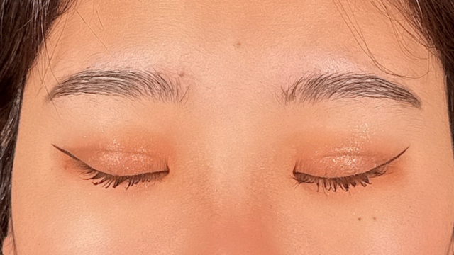 Postoperative Condition Part 1