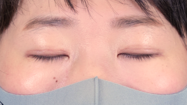 Postoperative Condition Part 1