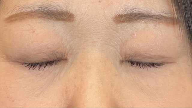 Postoperative Condition Part 1