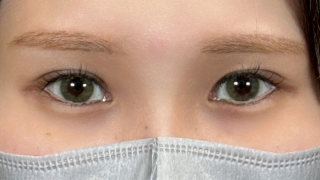 手术前的状态 其一