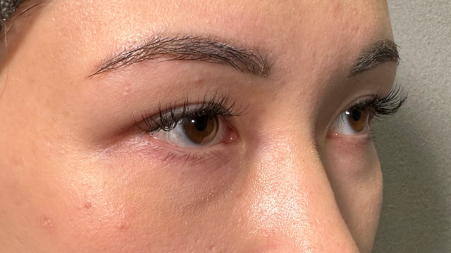 Preoperative Condition Part 1