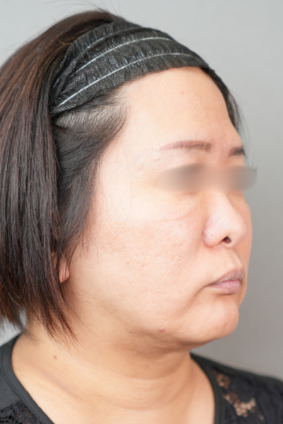 Preoperative Condition Part 1