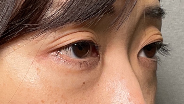 Preoperative Condition Part 1