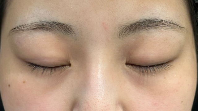 Preoperative Condition Part 1