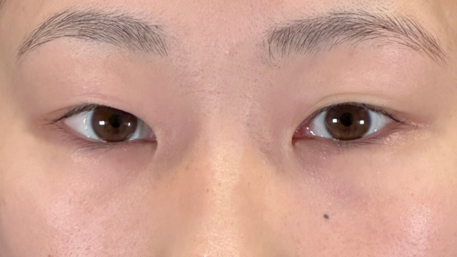 Preoperative Condition Part 1