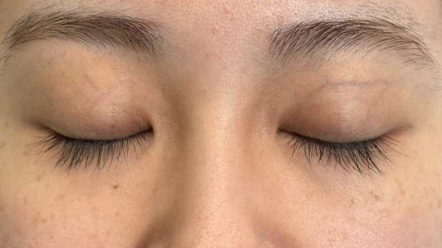 Preoperative Condition Part 1